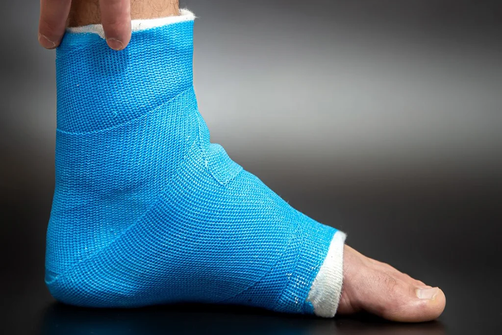 How to Care for Your Ankle After an Injury