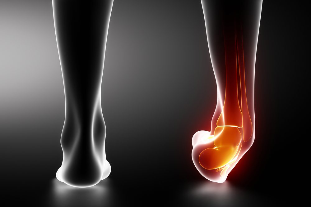 How to Heal from Ankle Injuries Quickly and Safely