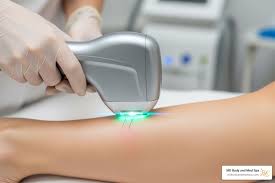 How to Maintain Smooth Skin After Laser Hair Removal