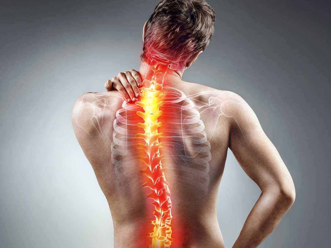 The Benefits of Undergoing Spine Surgery