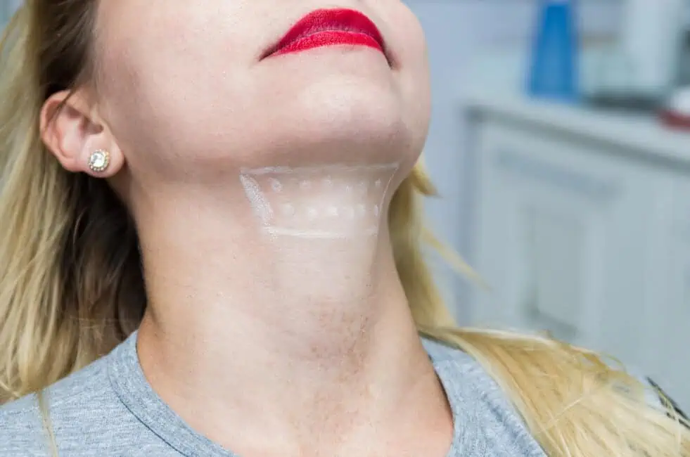 What To Expect Before, During, And After Kybella Treatment