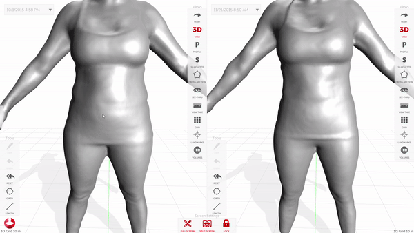 How Body Imaging Contributes to Diagnosing Obesity-Related Conditions