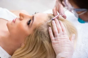 PRP Therapy: Addressing Common Misconceptions and FAQs