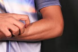 Signs and Symptoms of a Severe Allergic Reaction