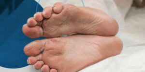 The Connection Between Diabetic Wound Care and Overall Health