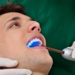 3 Tooth Conditions Endodontics Could Treat