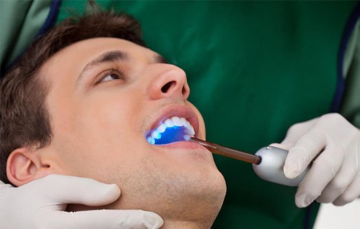 3 Tooth Conditions Endodontics Could Treat