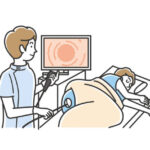 4 Signs You Need a Colon Cancer Screening