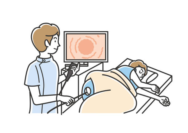 4 Signs You Need a Colon Cancer Screening