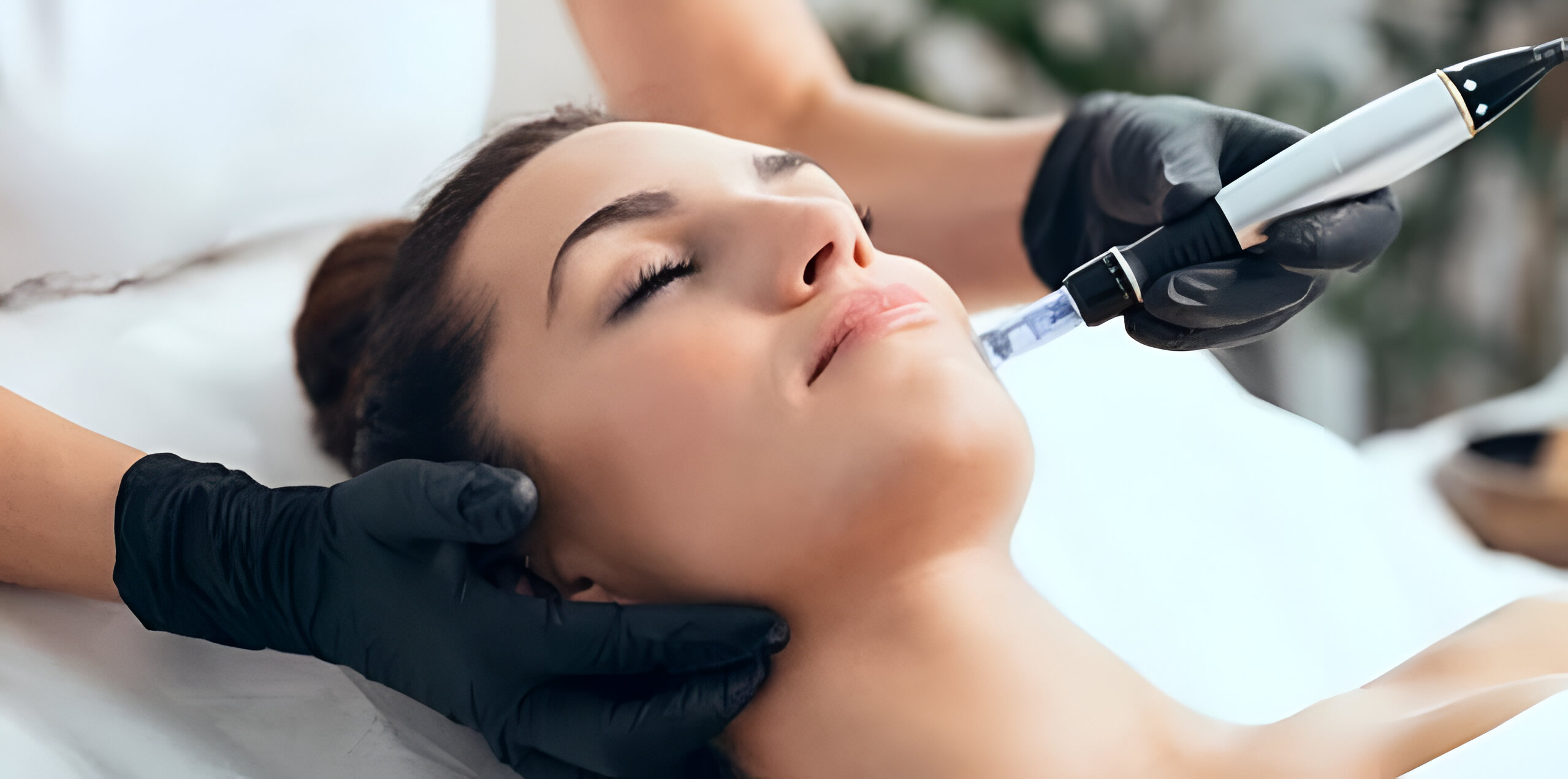 Microneedling Aftercare Tips for Optimal Results