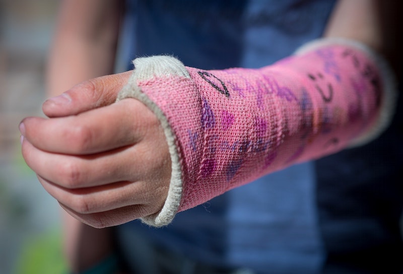 Signs of a Broken Bone and When To Seek Treatment