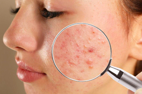 How Dermatologists Can Help with Skin Allergies and Irritations