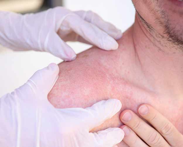 Early Signs of Skin Cancer and What You Should Know