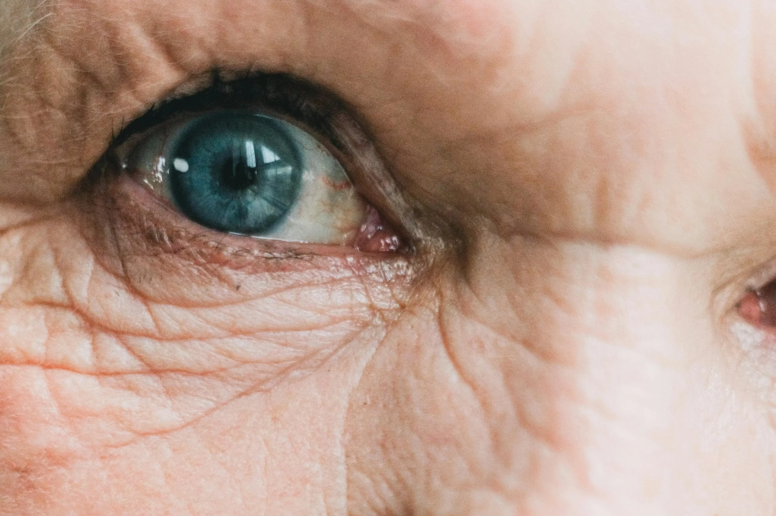 Lifestyle Changes To Manage Glaucoma